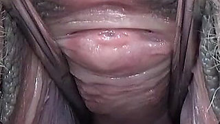 Vaginal Dilator 3. Experiments Continue.