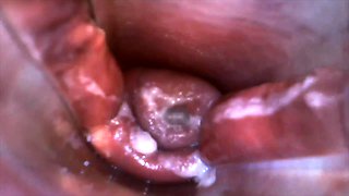 Play Speculum and View Inside My Pussy by Inside Camera