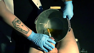 POV Patient. Sounding and Placing a Catheter